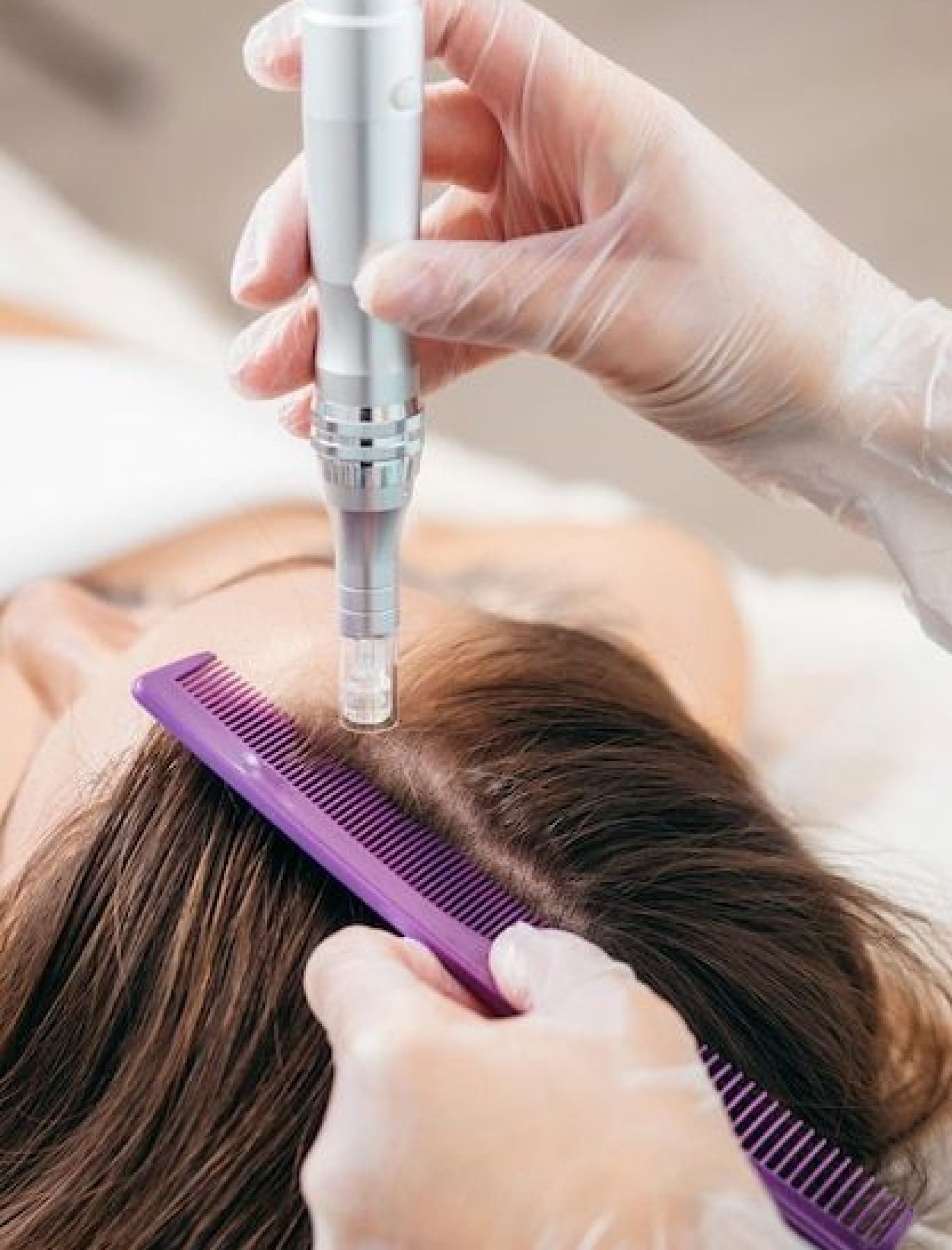 hairfall treatment