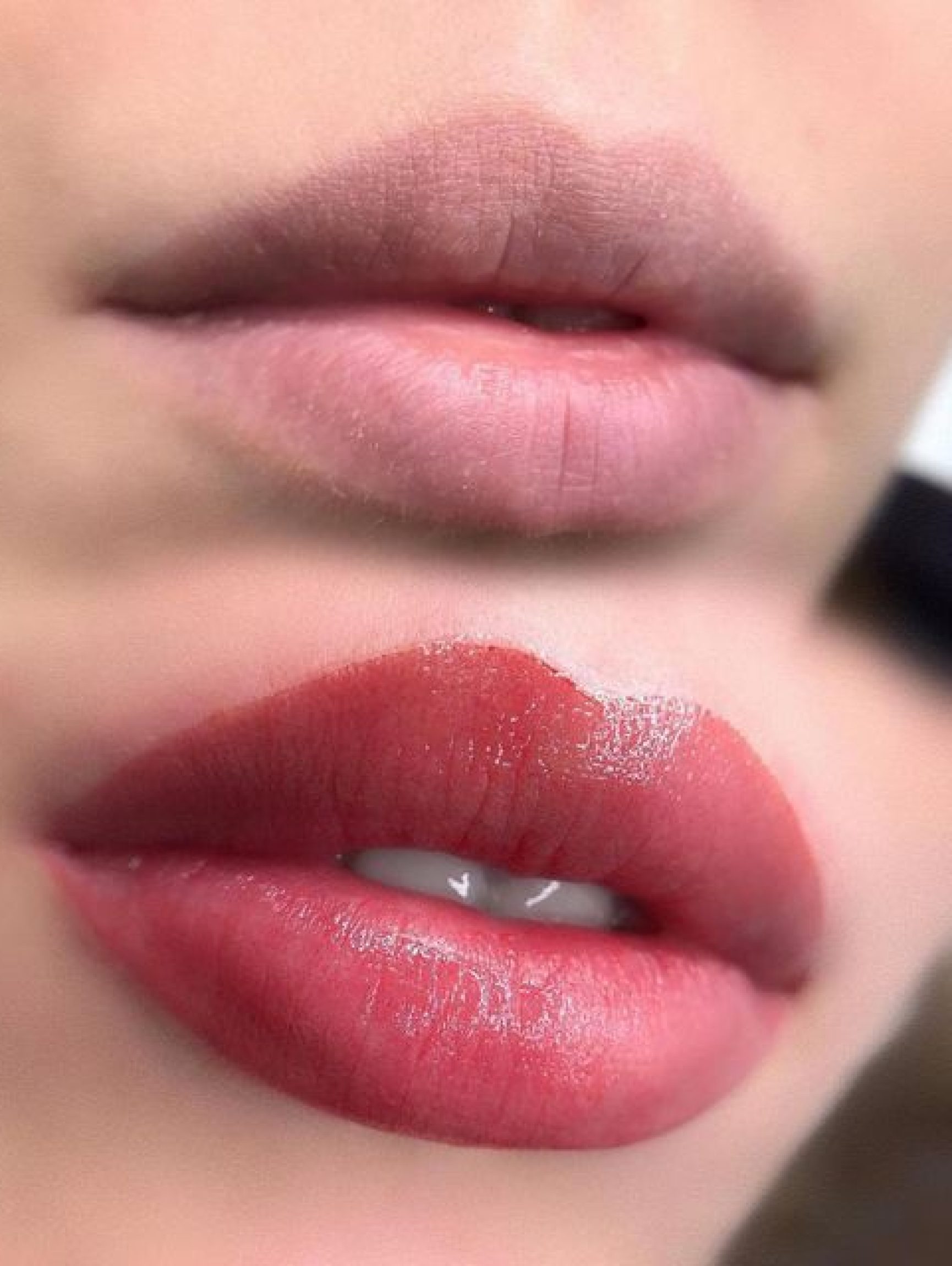 lipsneutralization lipsneutralization